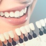 Should I Opt for Cosmetic Dentistry?- Reasons Discussed in Detail 