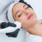 Skin Rejuvenation- Laser Genesis Treatment In The Best Medical Spa in Houston, TX. New You Wellness Center.