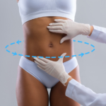 Where to find a qualified surgeon for lipo 360?